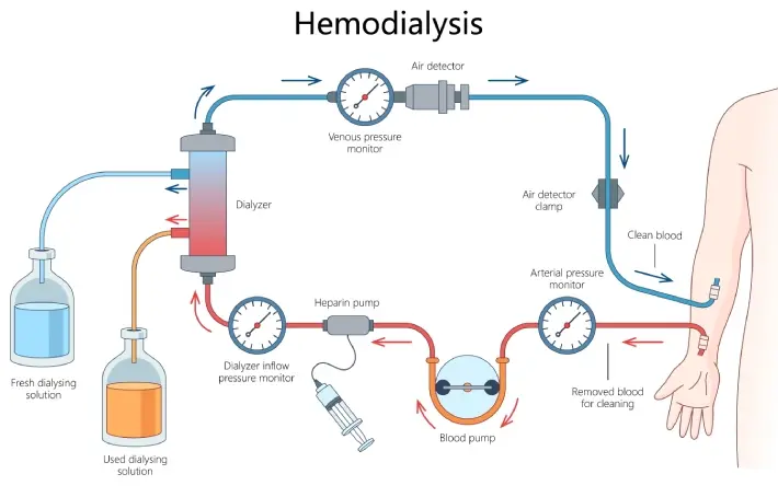 Hemodialysis Medical Education Wallpaper